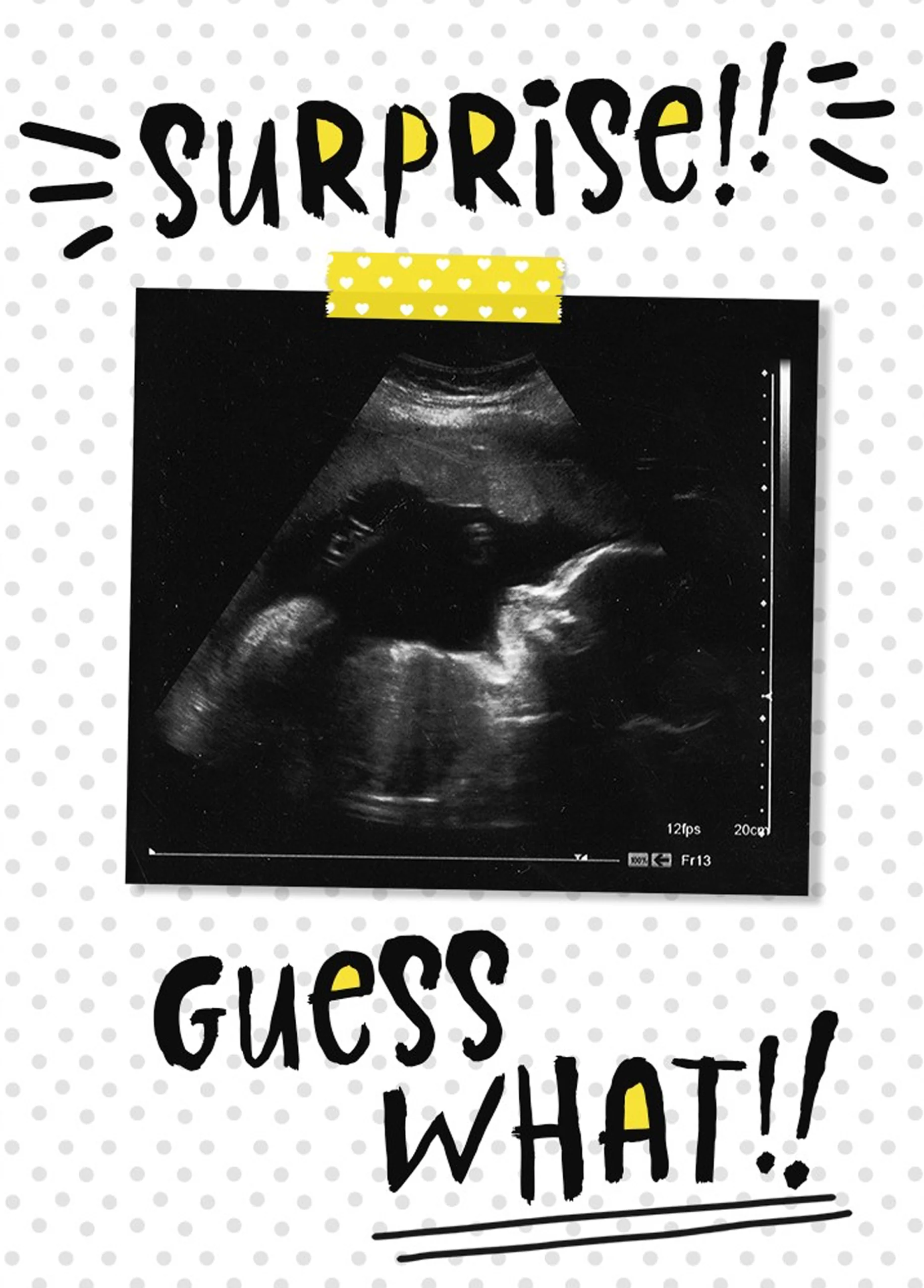 Personalised Surprise Guess What!? Pregnancy Photo Card