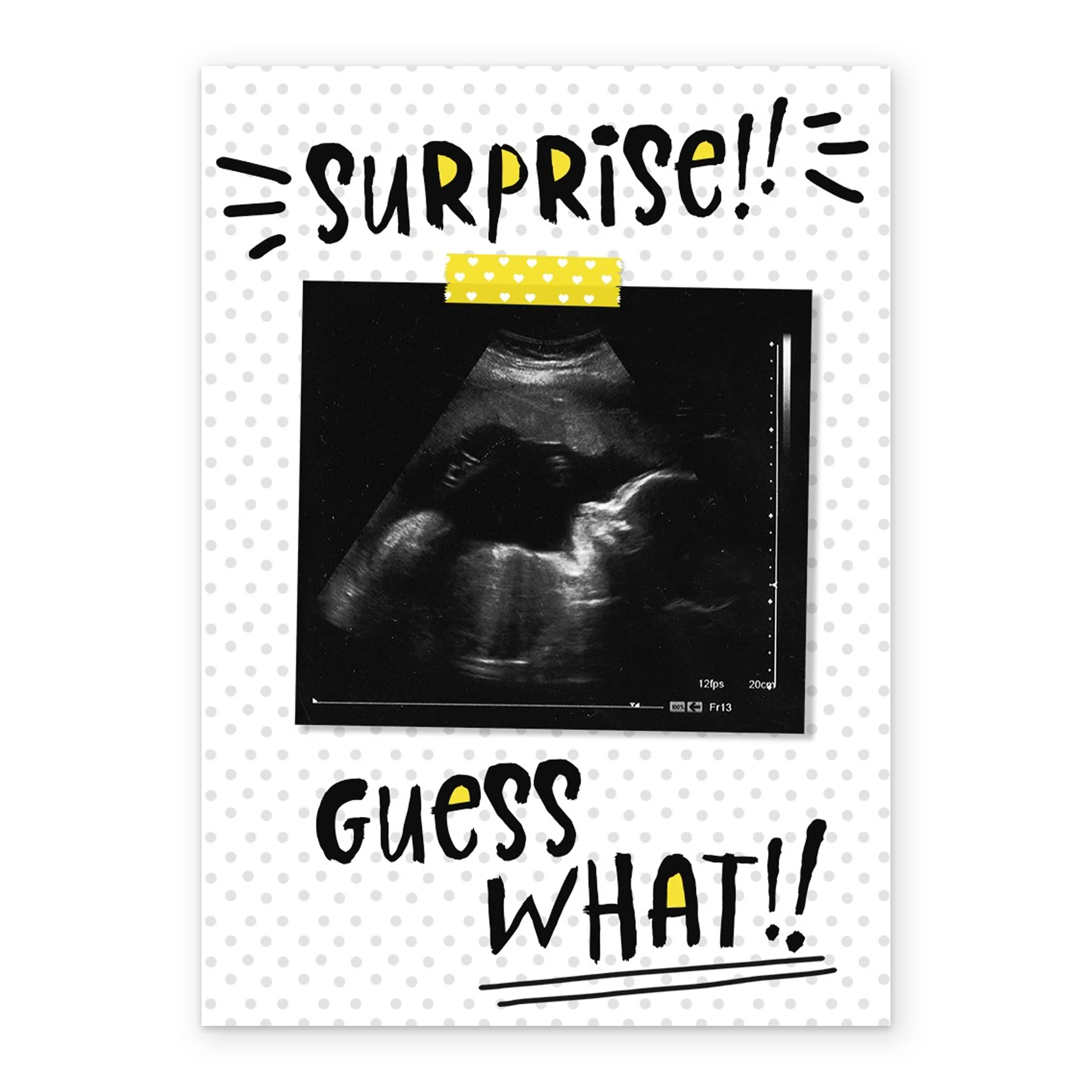 Personalised Surprise Guess What!? Pregnancy Photo Card - Image 2